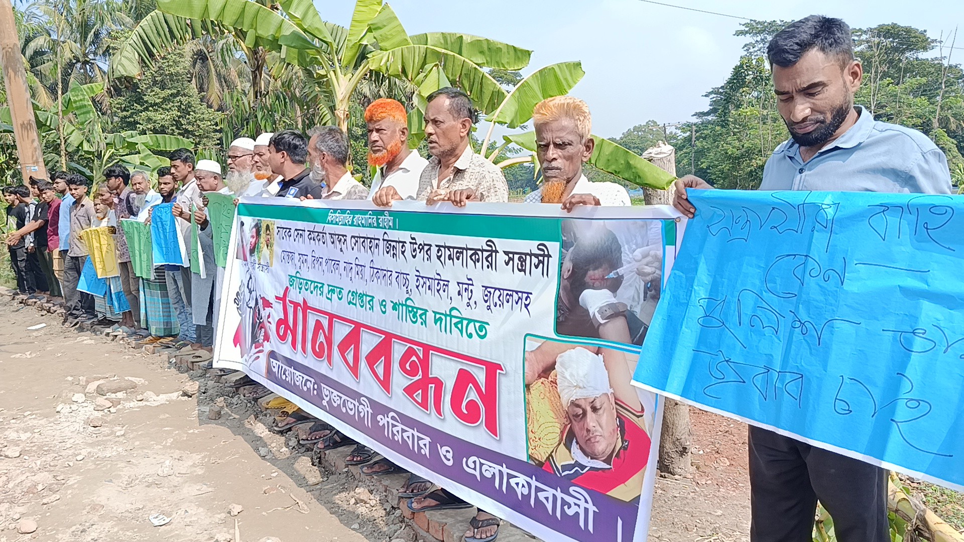 নোয়াখালীতে সাবেক সেনা কর্মকর্তার ওপর হামলার প্রতিবাদে মানববন্ধন