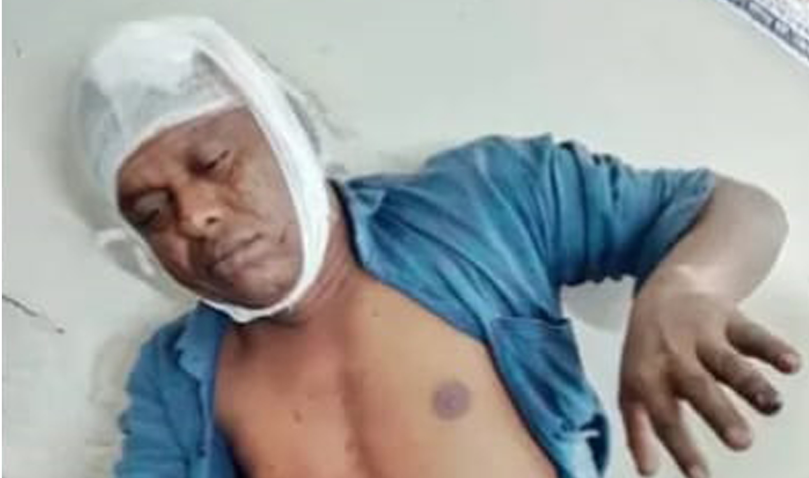 সুবর্ণচরে চাঁদাবাজির প্রতিবাদ করায় বিএনপি কর্মীকে কুপিয়ে আহত